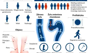 Ilustracja przedstawia żylaki, ich objawy, czynniki ryzyka (w tym uwarunkowania genetyczne) oraz metody leczenia, takie jak skleroterapia.