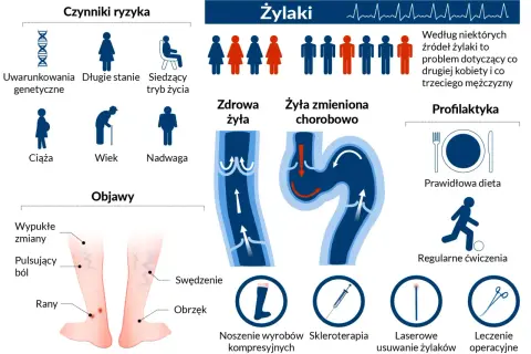 Ilustracja przedstawia żylaki, ich objawy, czynniki ryzyka (w tym uwarunkowania genetyczne) oraz metody leczenia, takie jak skleroterapia.