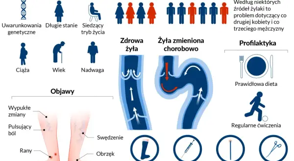 Ilustracja przedstawia żylaki, ich objawy, czynniki ryzyka (w tym uwarunkowania genetyczne) oraz metody leczenia, takie jak skleroterapia.